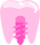 Implant